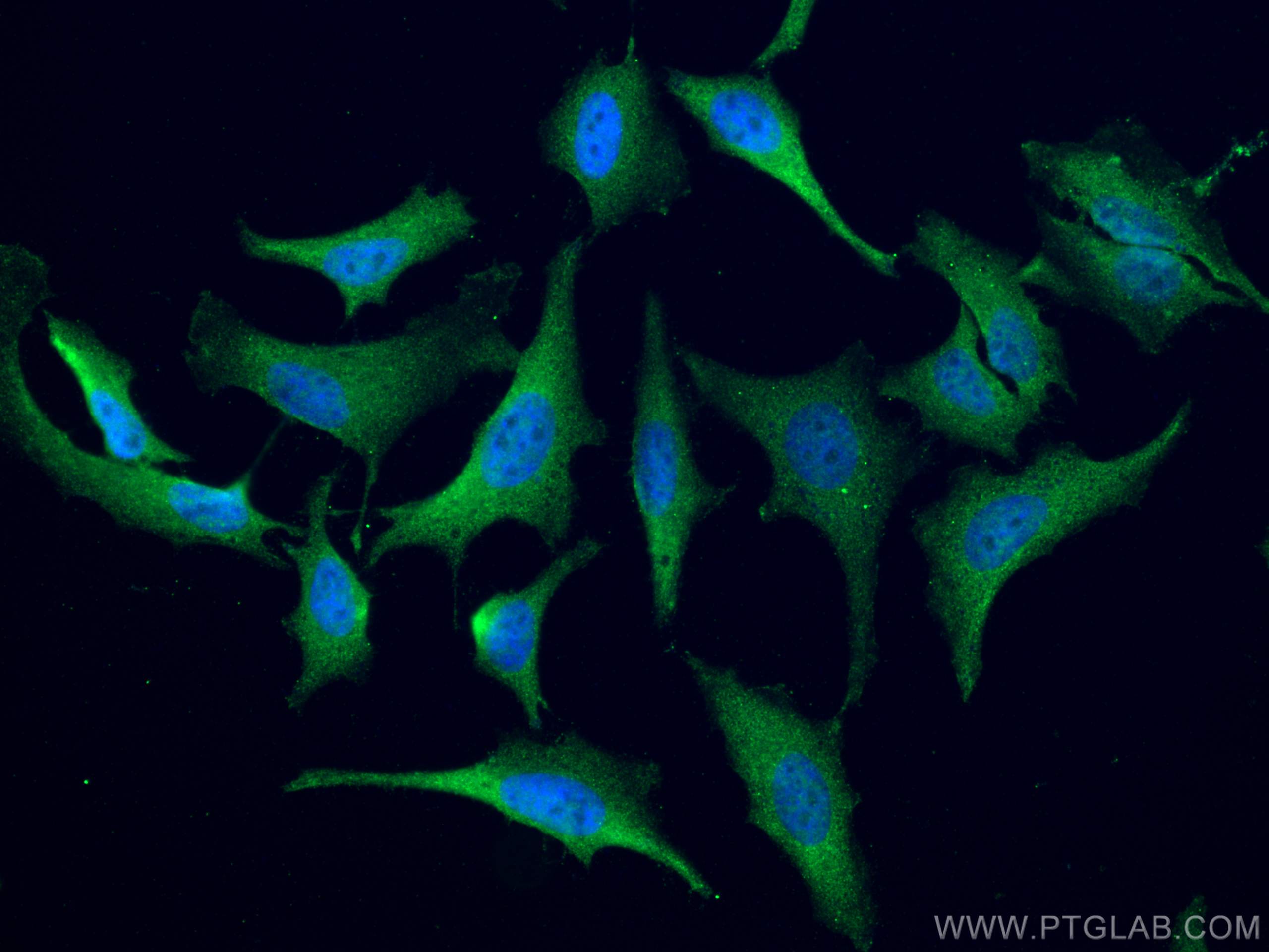 Immunofluorescence (IF) / fluorescent staining of HeLa cells using ATM Polyclonal antibody (27156-1-AP)