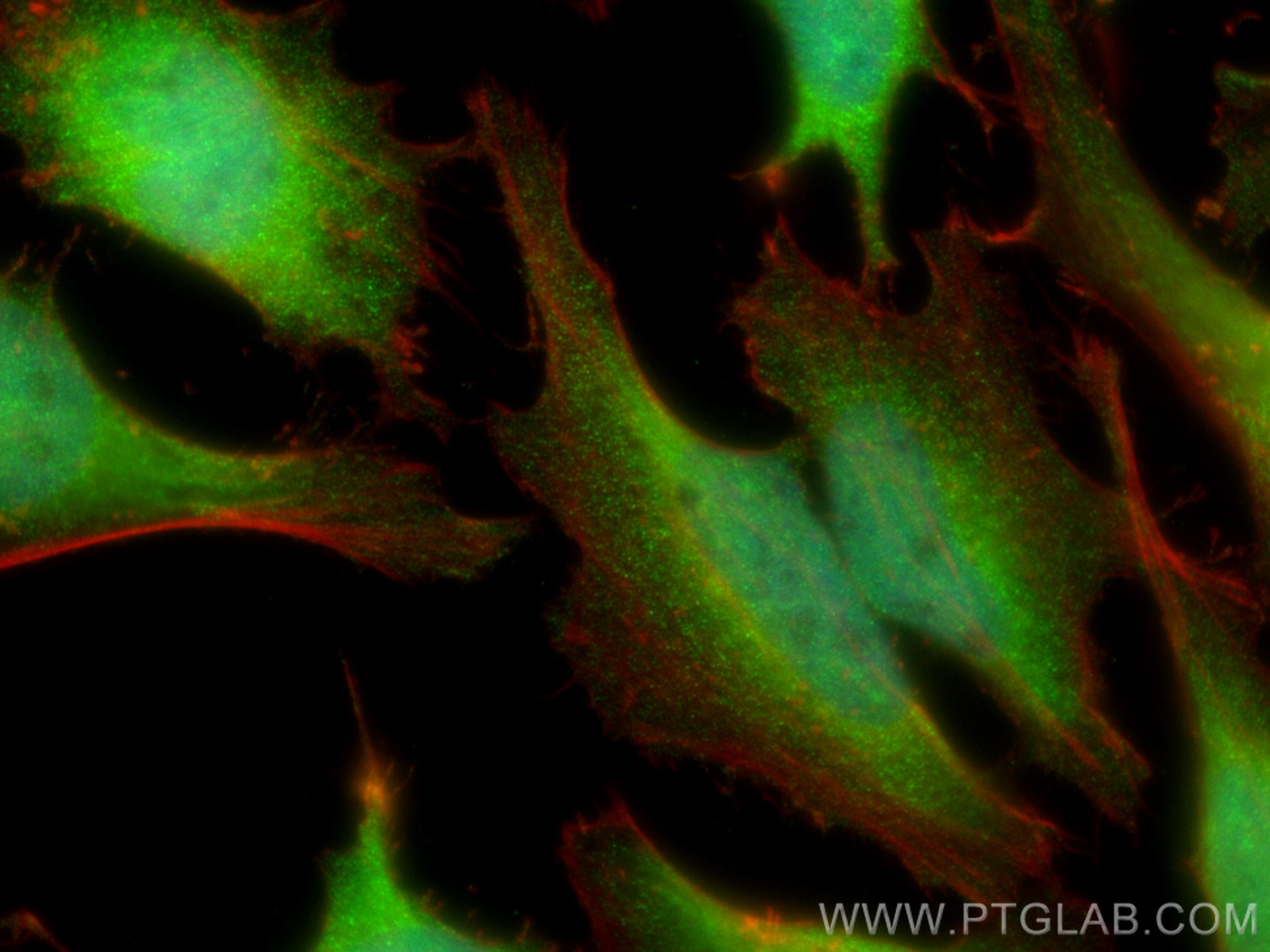 Immunofluorescence (IF) / fluorescent staining of HeLa cells using ATM Polyclonal antibody (27156-1-AP)