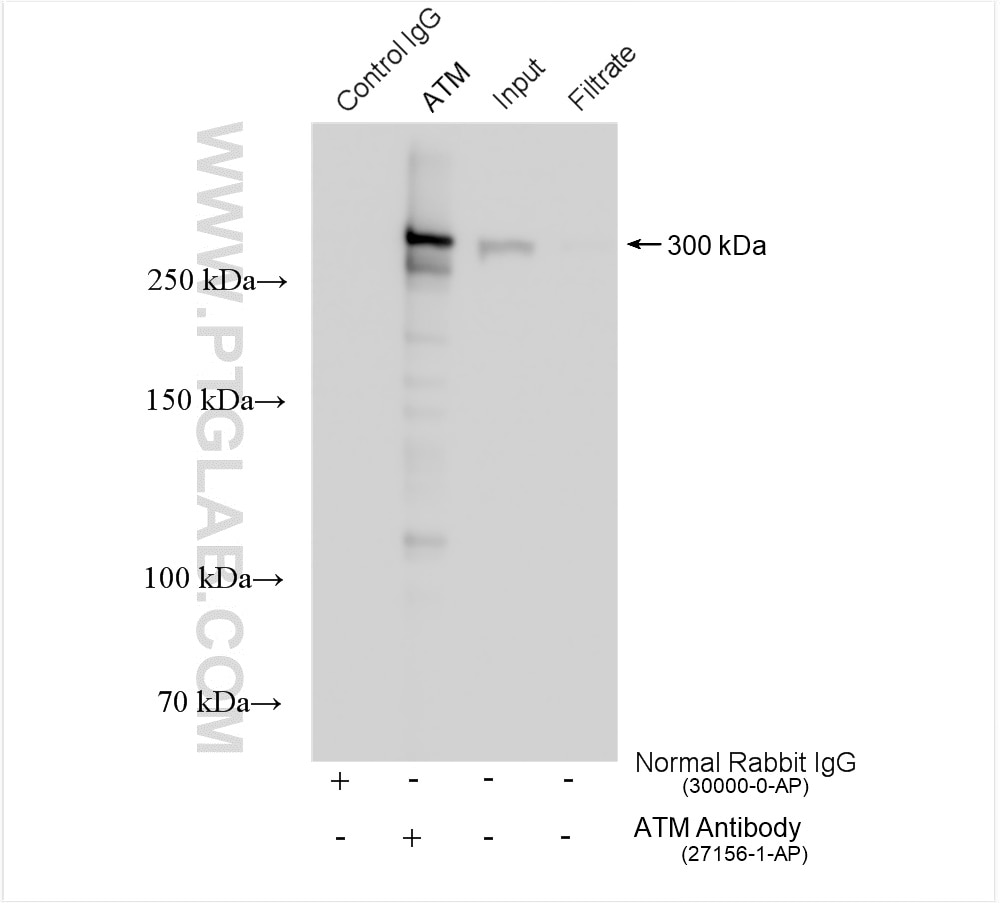 Immunoprecipitation (IP) experiment of HEK-293 cells using ATM Polyclonal antibody (27156-1-AP)