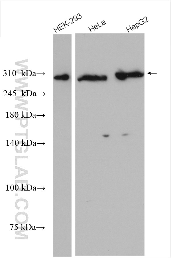 Western Blot (WB) analysis of various lysates using ATM Polyclonal antibody (27156-1-AP)