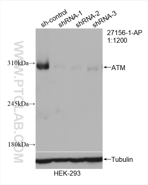 Western Blot (WB) analysis of HEK-293 cells using ATM Polyclonal antibody (27156-1-AP)