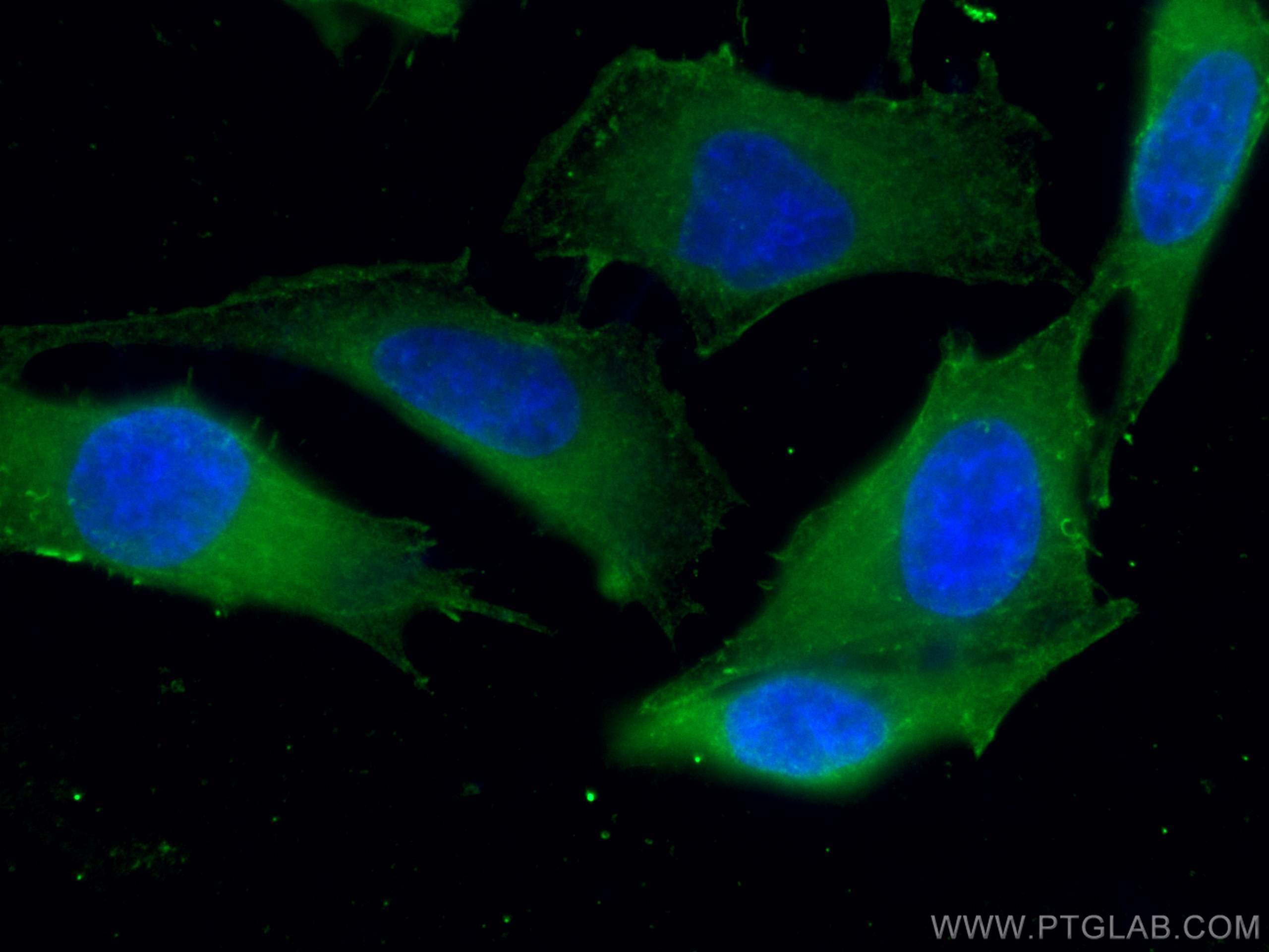 Immunofluorescence (IF) / fluorescent staining of HeLa cells using ATM Monoclonal antibody (67586-1-Ig)