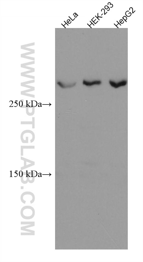 Western Blot (WB) analysis of various lysates using ATM Monoclonal antibody (67586-1-Ig)