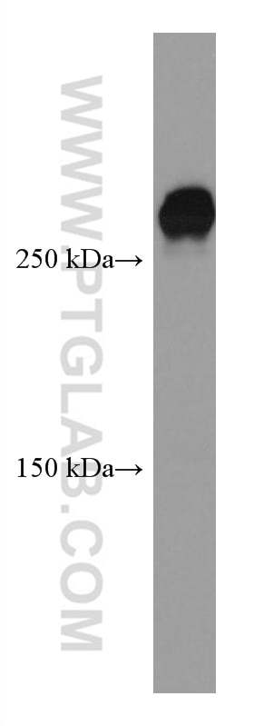 Western Blot (WB) analysis of HSC-T6 cells using ATM Monoclonal antibody (67586-1-Ig)