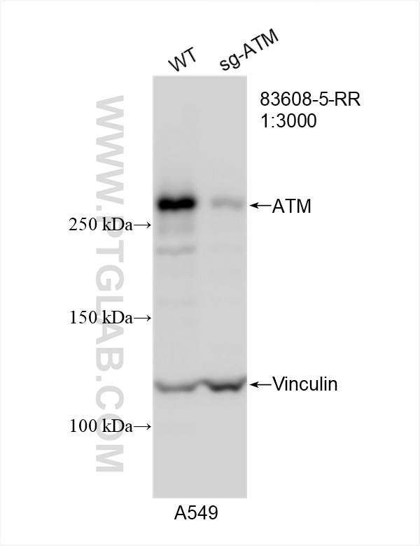 Western Blot (WB) analysis of A549 cells using ATM Recombinant antibody (83608-5-RR)