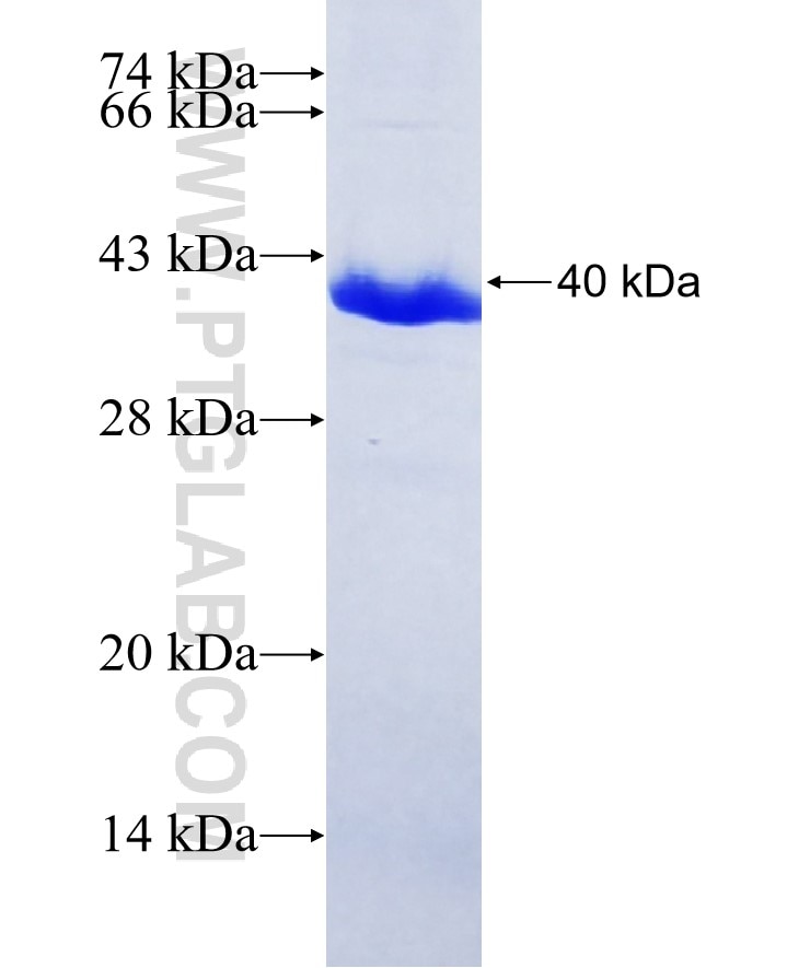 ATM fusion protein Ag25920 SDS-PAGE