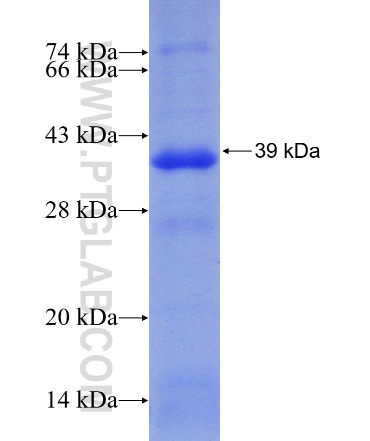 ATM fusion protein Ag30001 SDS-PAGE