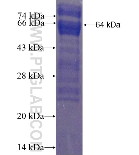 ATMIN fusion protein Ag15810 SDS-PAGE