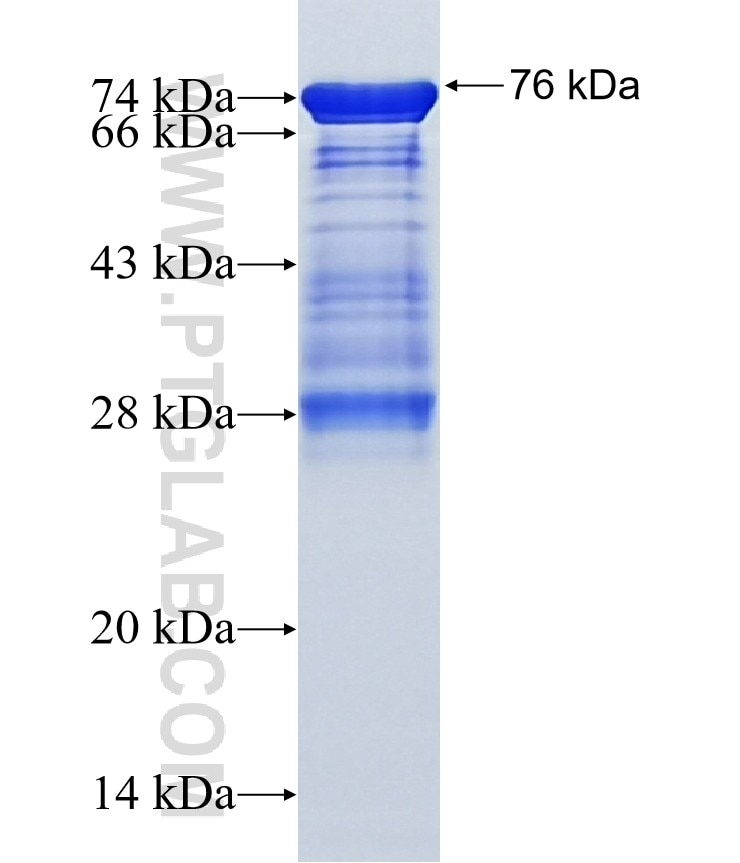 ATMIN fusion protein Ag15810 SDS-PAGE