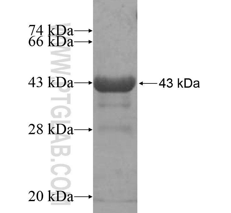 ATMPK8 fusion protein Ag14397 SDS-PAGE