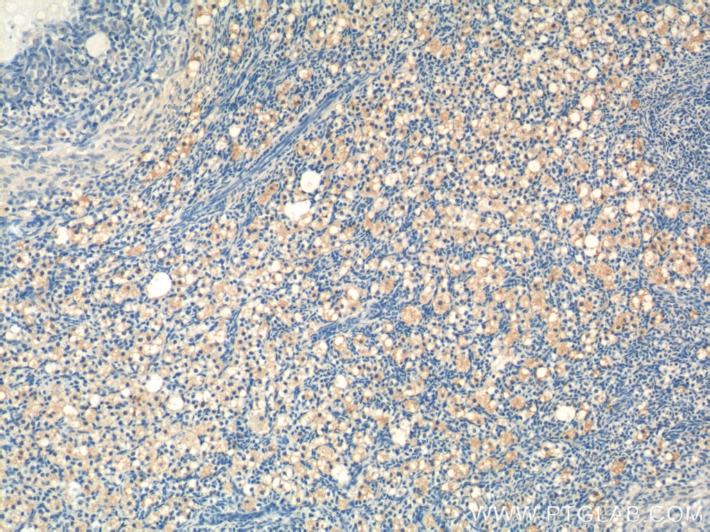 Immunohistochemistry (IHC) staining of human ovary tissue using ATN1 Polyclonal antibody (19243-1-AP)