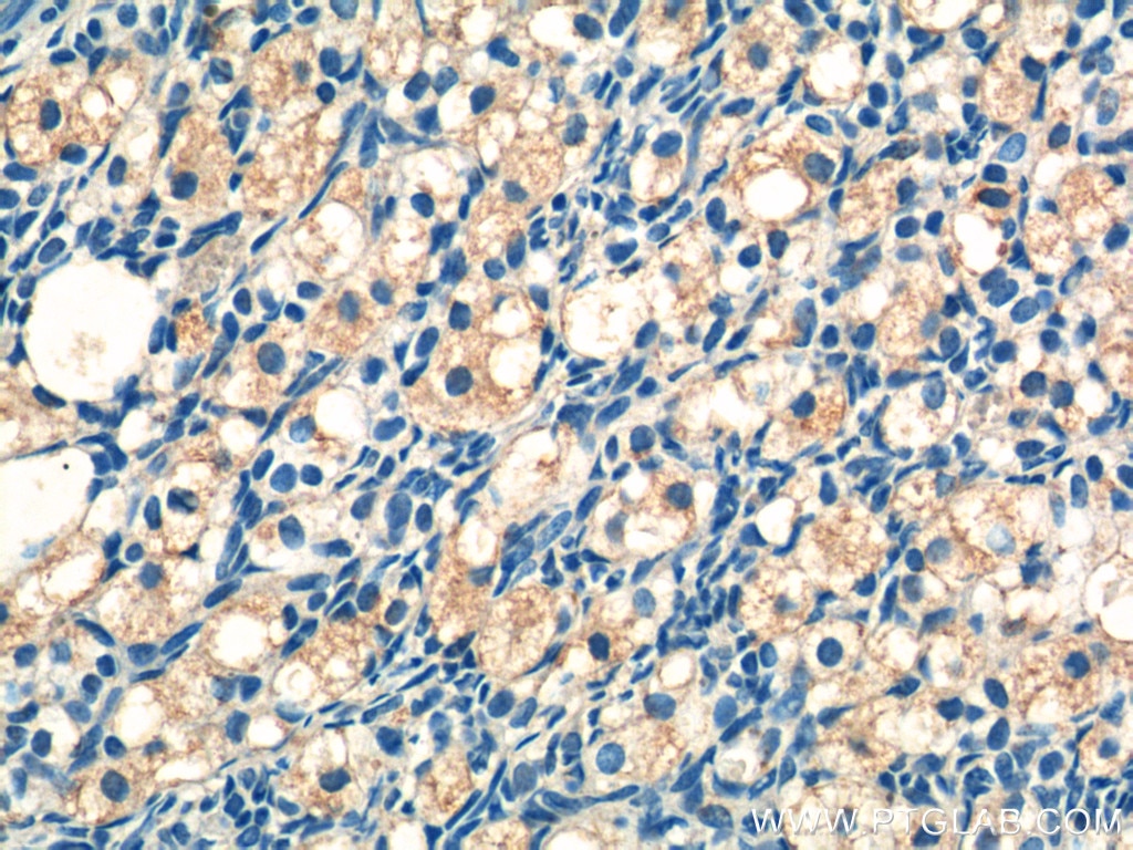 Immunohistochemistry (IHC) staining of human ovary tissue using ATN1 Polyclonal antibody (19243-1-AP)