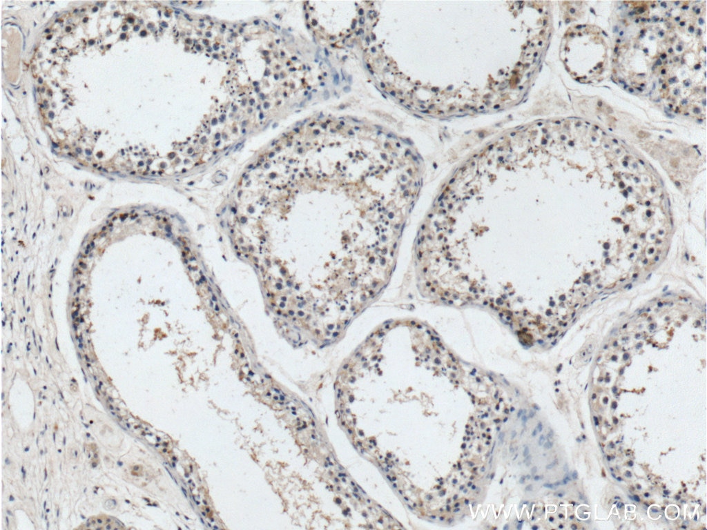 Immunohistochemistry (IHC) staining of human testis tissue using ATN1 Polyclonal antibody (19243-1-AP)