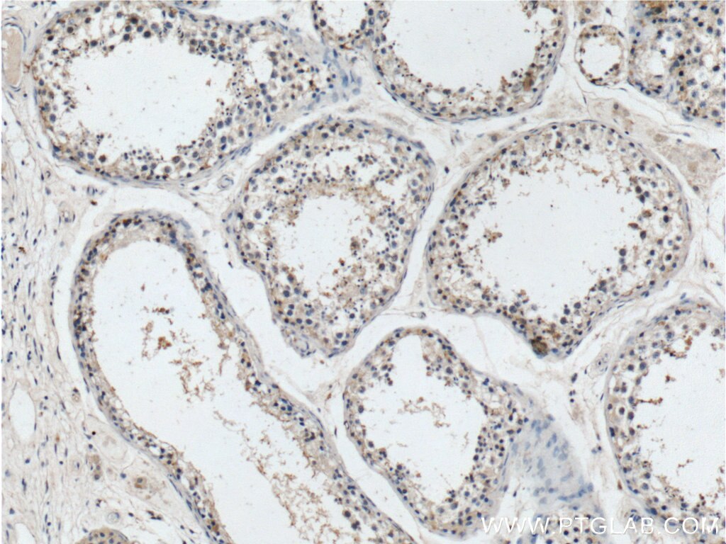 IHC staining of human testis using 19243-1-AP