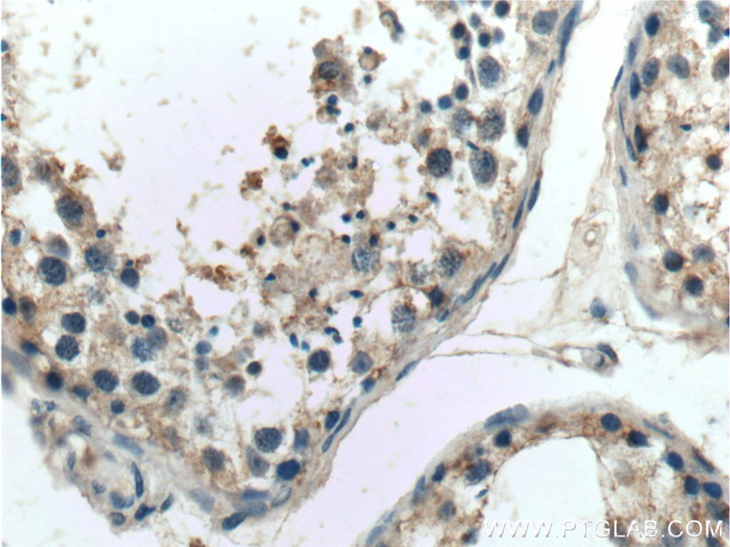 IHC staining of human testis using 19243-1-AP