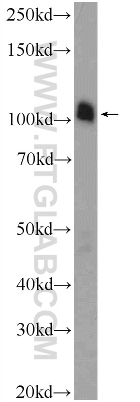 Western Blot (WB) analysis of mouse testis tissue using ATN1 Polyclonal antibody (19243-1-AP)