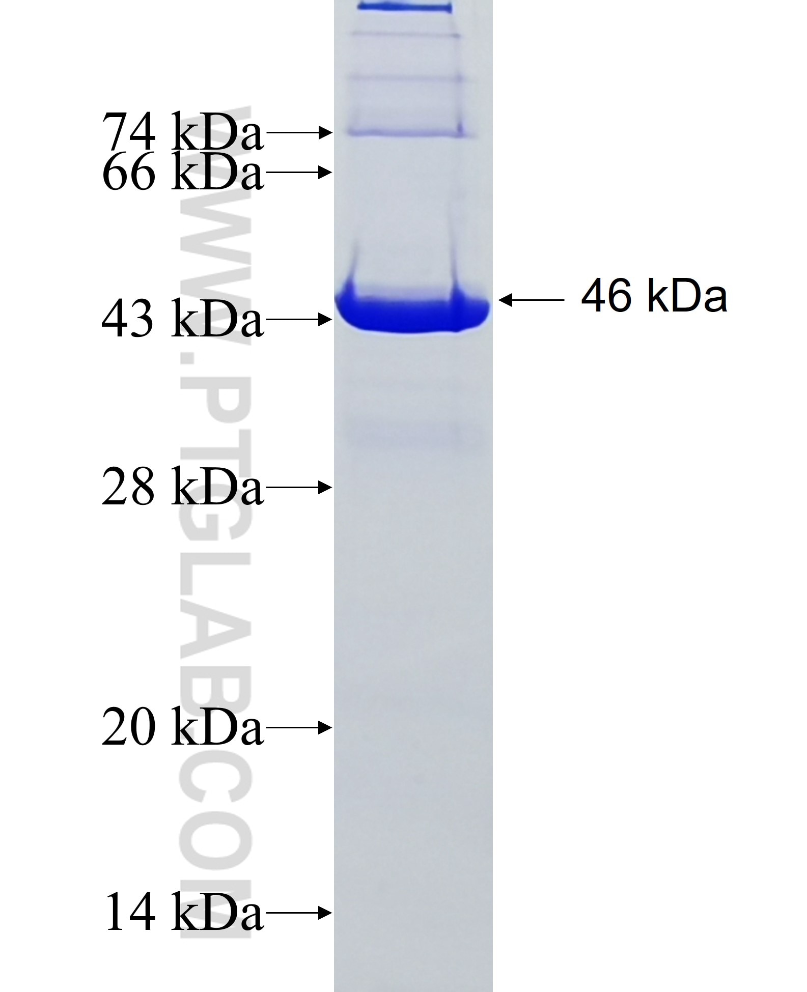 ATN1 fusion protein Ag5835 SDS-PAGE