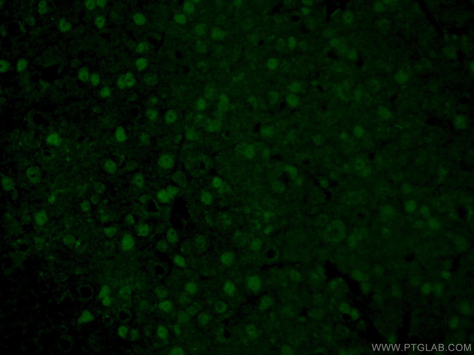 Immunofluorescence (IF) / fluorescent staining of mouse brain tissue using ATOH1 Polyclonal antibody (21215-1-AP)