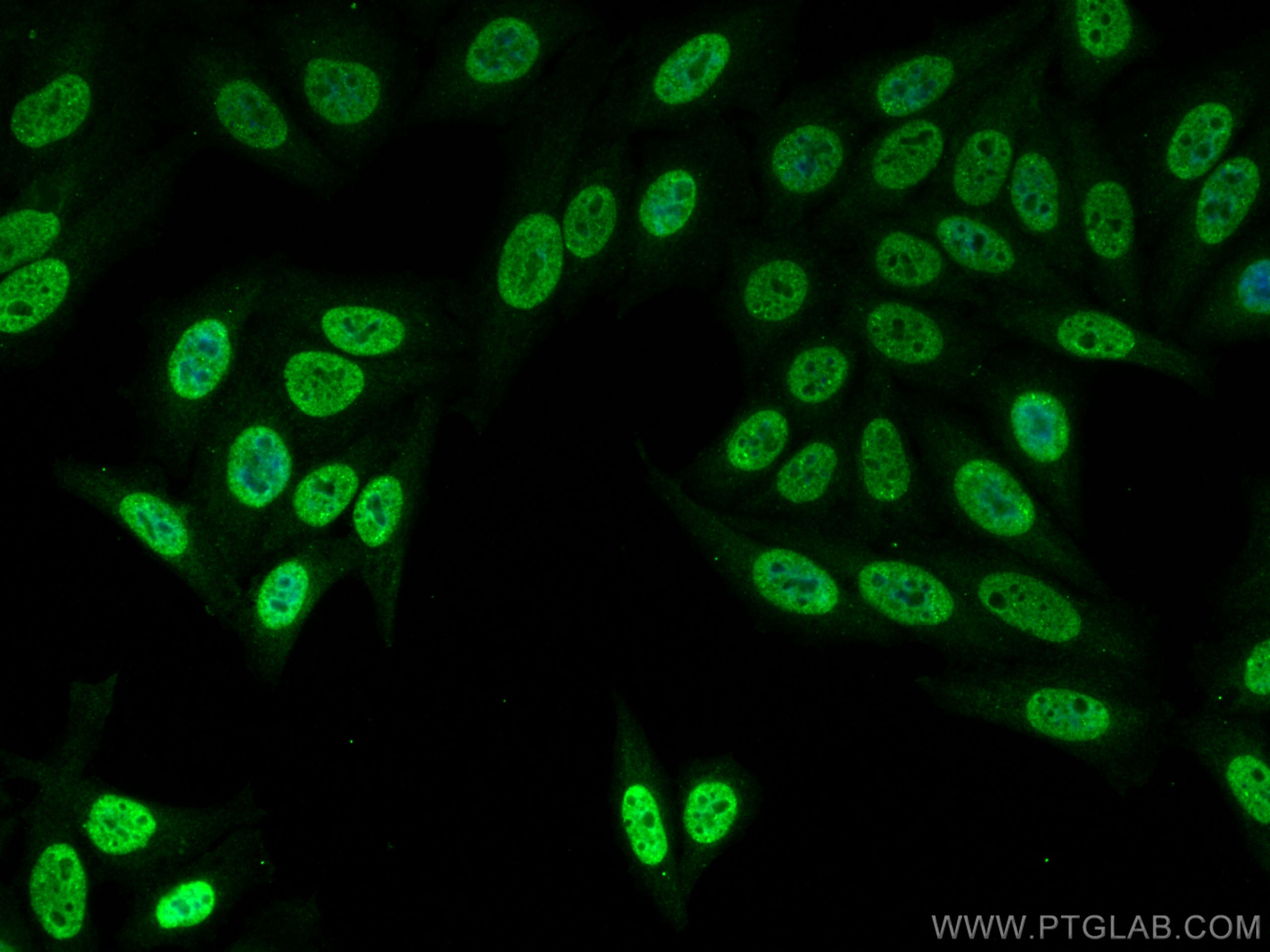 Immunofluorescence (IF) / fluorescent staining of HepG2 cells using ATOH1 Polyclonal antibody (21215-1-AP)
