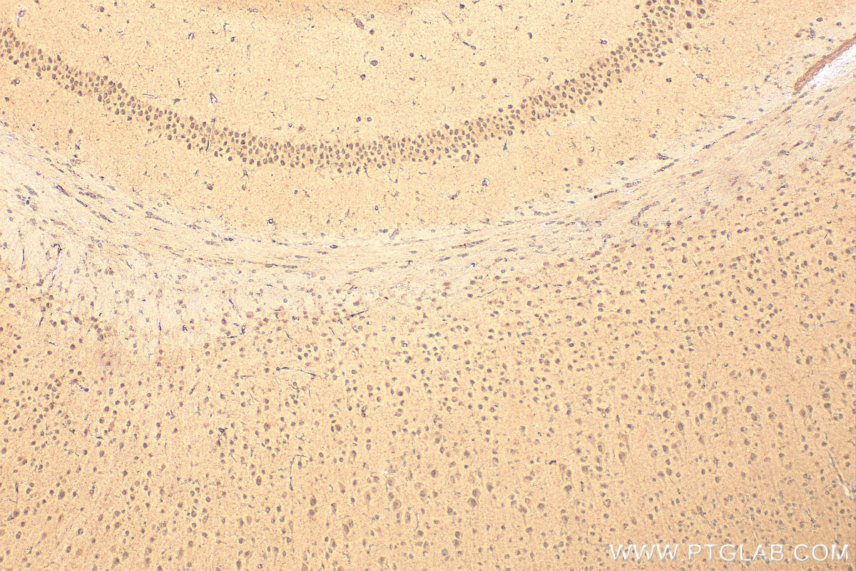 Immunohistochemistry (IHC) staining of mouse brain tissue using ATOH1 Polyclonal antibody (21215-1-AP)