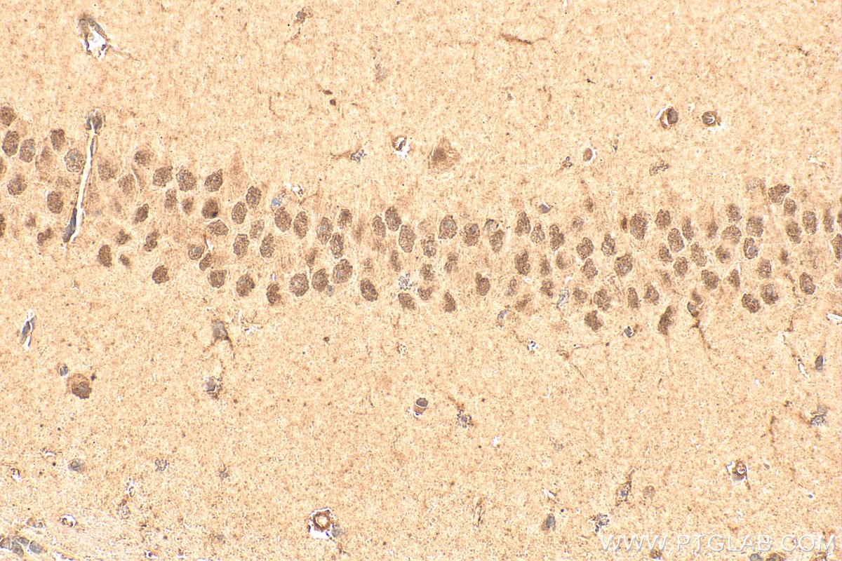 Immunohistochemistry (IHC) staining of mouse brain tissue using ATOH1 Polyclonal antibody (21215-1-AP)