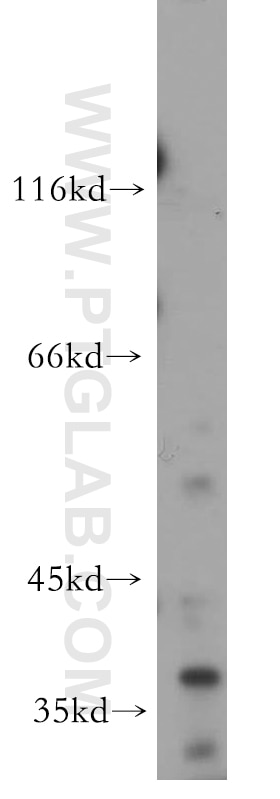 ATOH1 Polyclonal antibody