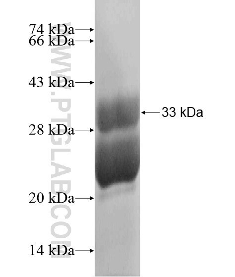 ATOH7 fusion protein Ag19967 SDS-PAGE