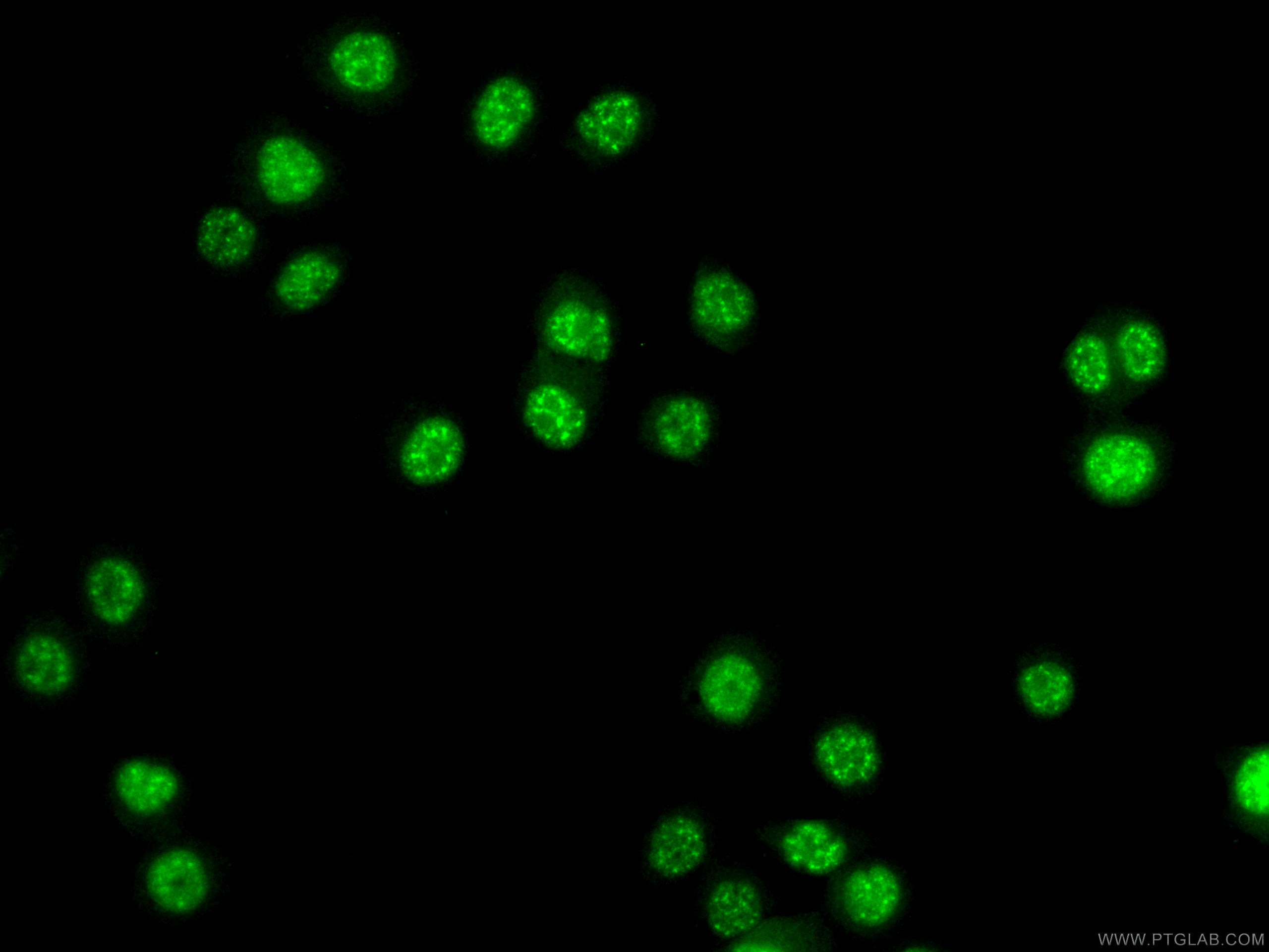 Immunofluorescence (IF) / fluorescent staining of PC-3 cells using ATOX1 Polyclonal antibody (22641-1-AP)