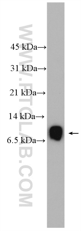 Western Blot (WB) analysis of HEK-293T cells using ATOX1 Polyclonal antibody (22641-1-AP)
