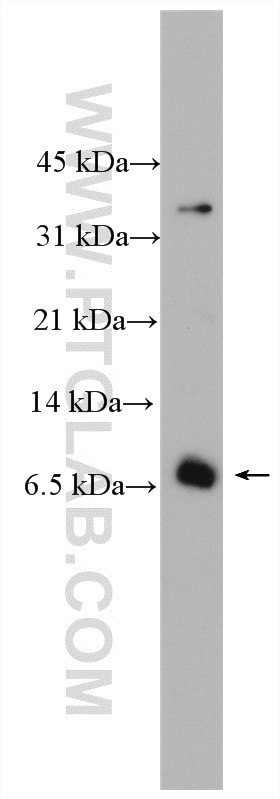 Western Blot (WB) analysis of A549 cells using ATOX1 Polyclonal antibody (22641-1-AP)
