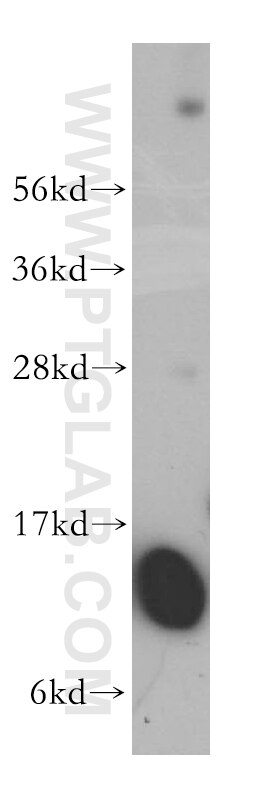 ATP11B