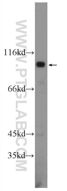 Western Blot (WB) analysis of A431 cells using ATP12A Polyclonal antibody (13231-1-AP)