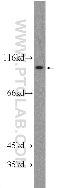 Western Blot (WB) analysis of HEK-293 cells using ATP12A Polyclonal antibody (13231-1-AP)