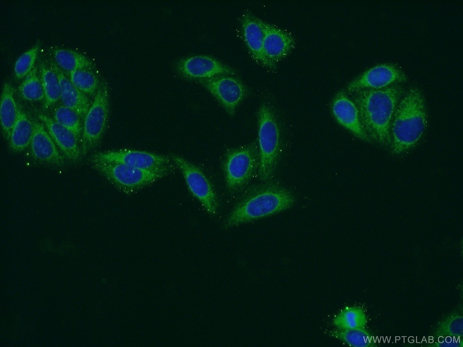 Immunofluorescence (IF) / fluorescent staining of HepG2 cells using ATP13A1 Polyclonal antibody (16244-1-AP)
