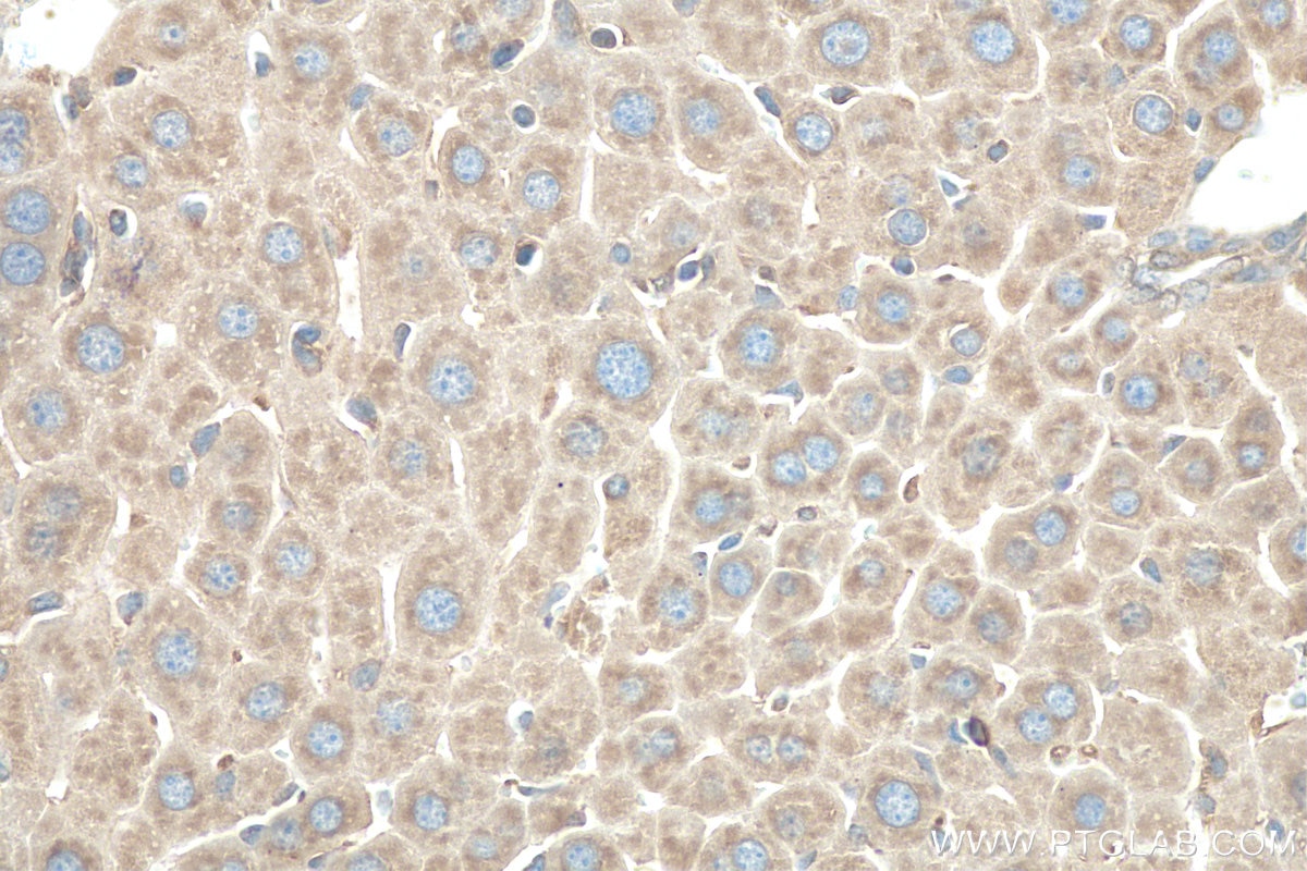 Immunohistochemistry (IHC) staining of mouse liver tissue using ATP13A1 Polyclonal antibody (16244-1-AP)