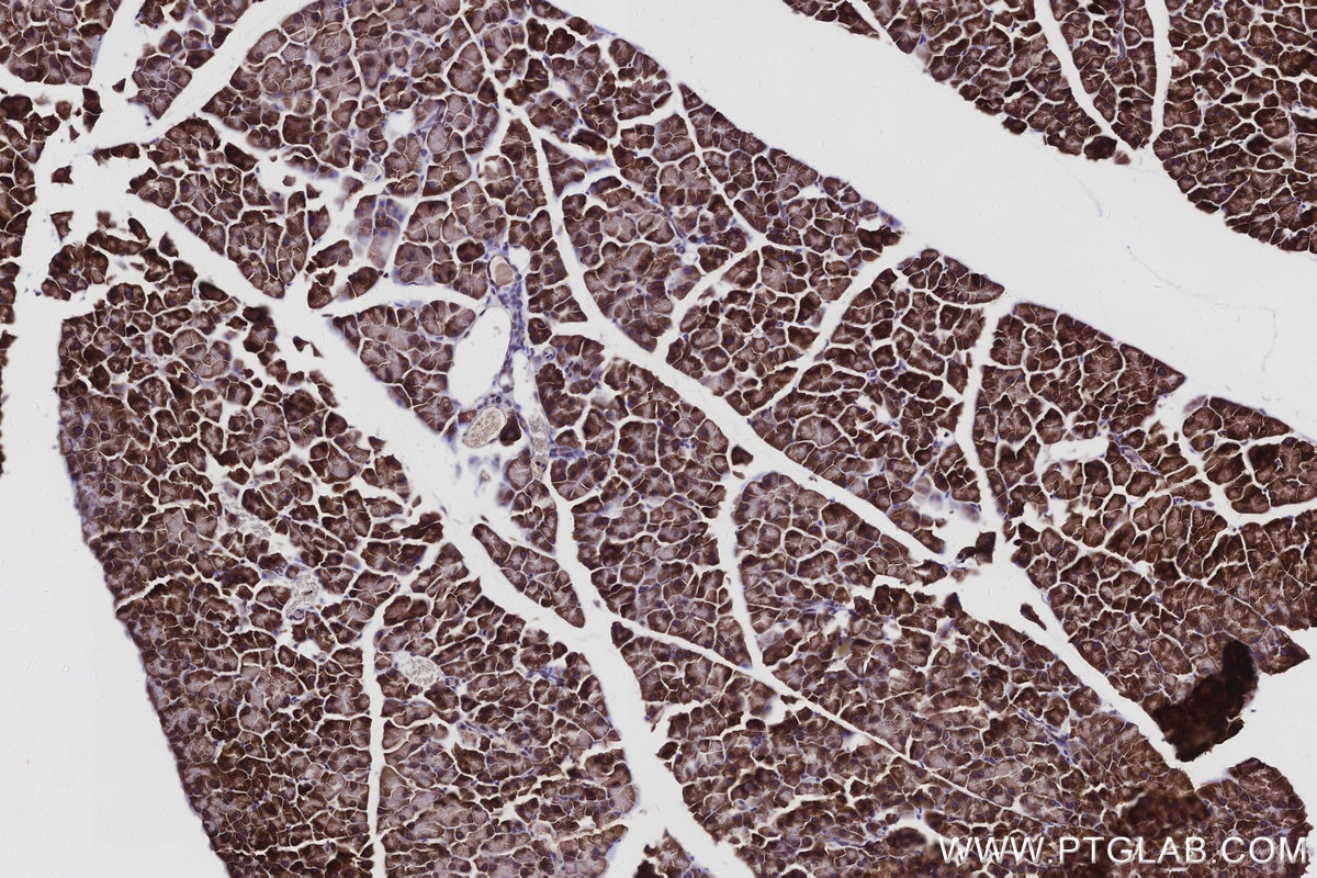 IHC staining of mouse pancreas using 16244-1-AP Immunohistochemistry (IHC) staining of mouse pancreas tissue using ATP13A1 Polyclonal antibody (16244-1-AP)