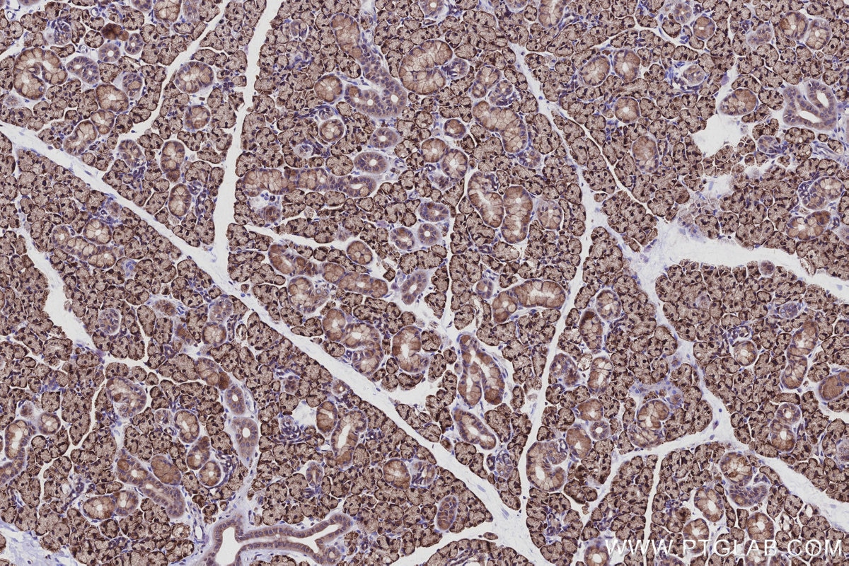IHC staining of rat salivary gland using 16244-1-AP Immunohistochemistry (IHC) staining of rat salivary gland tissue using ATP13A1 Polyclonal antibody (16244-1-AP)