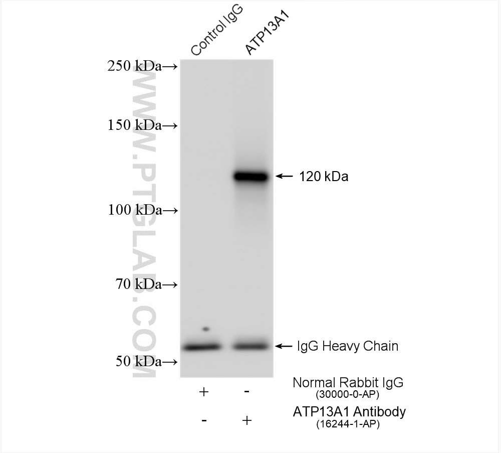 Immunoprecipitation (IP) experiment of HeLa cells using ATP13A1 Polyclonal antibody (16244-1-AP)