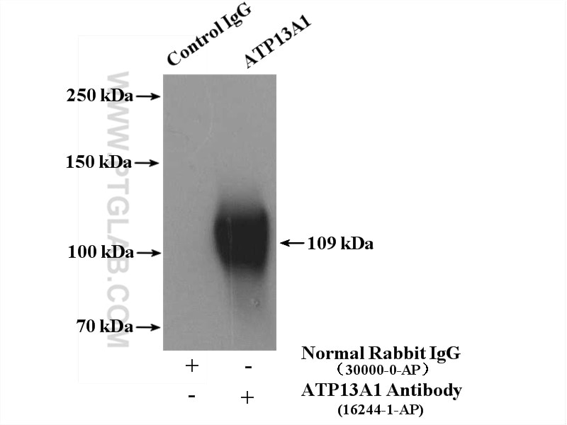 Immunoprecipitation (IP) experiment of HeLa cells using ATP13A1 Polyclonal antibody (16244-1-AP)