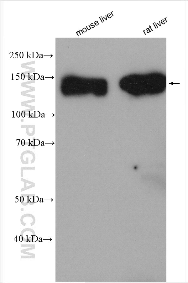 Western Blot (WB) analysis of various lysates using ATP13A1 Polyclonal antibody (16244-1-AP)