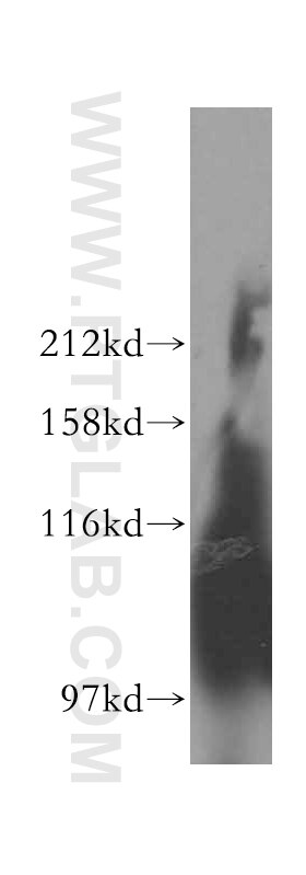 ATP13A1