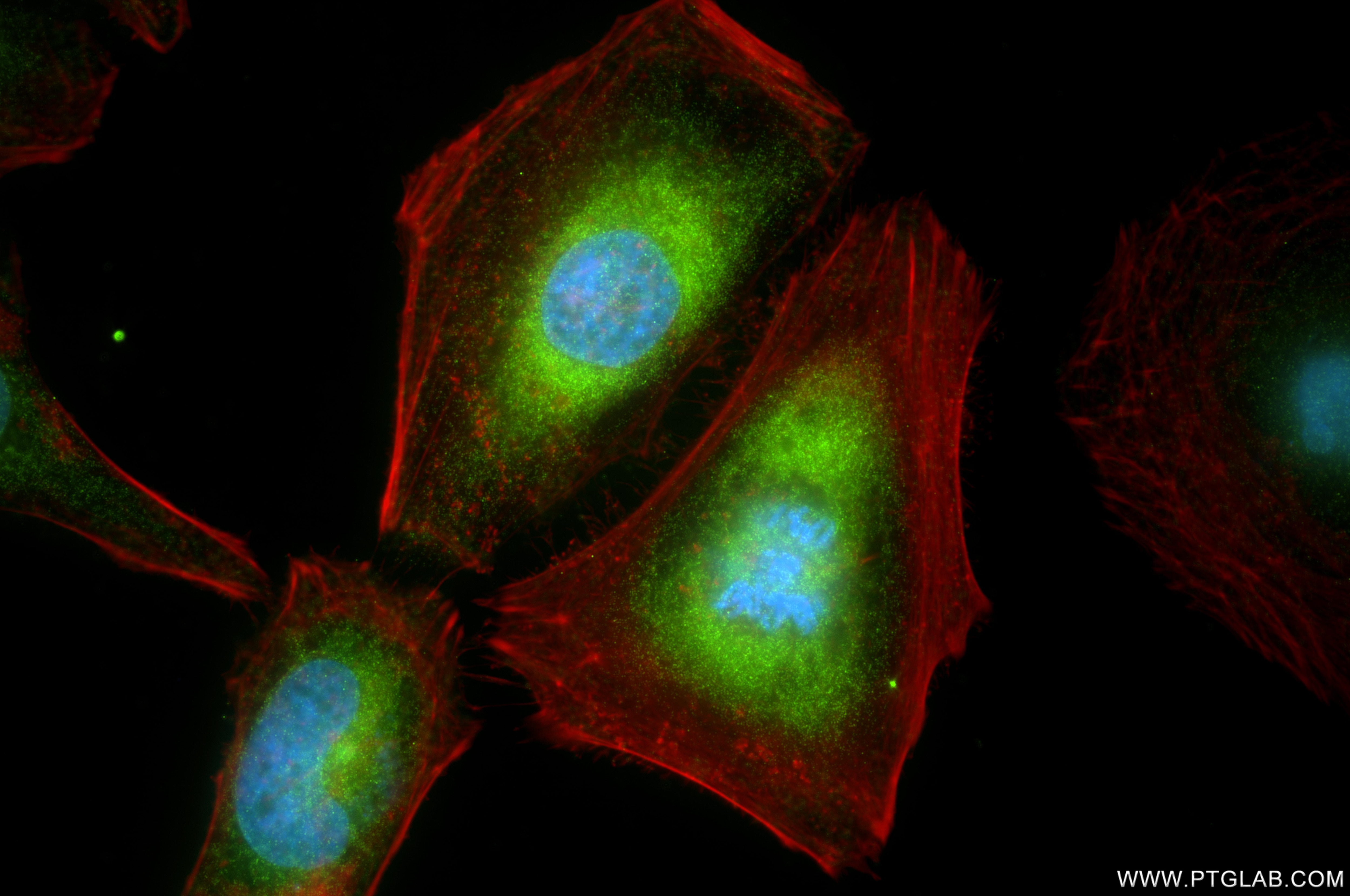 Immunofluorescence (IF) / fluorescent staining of HeLa cells using ATP13A1 Recombinant monoclonal antibody (86762-3-RR)