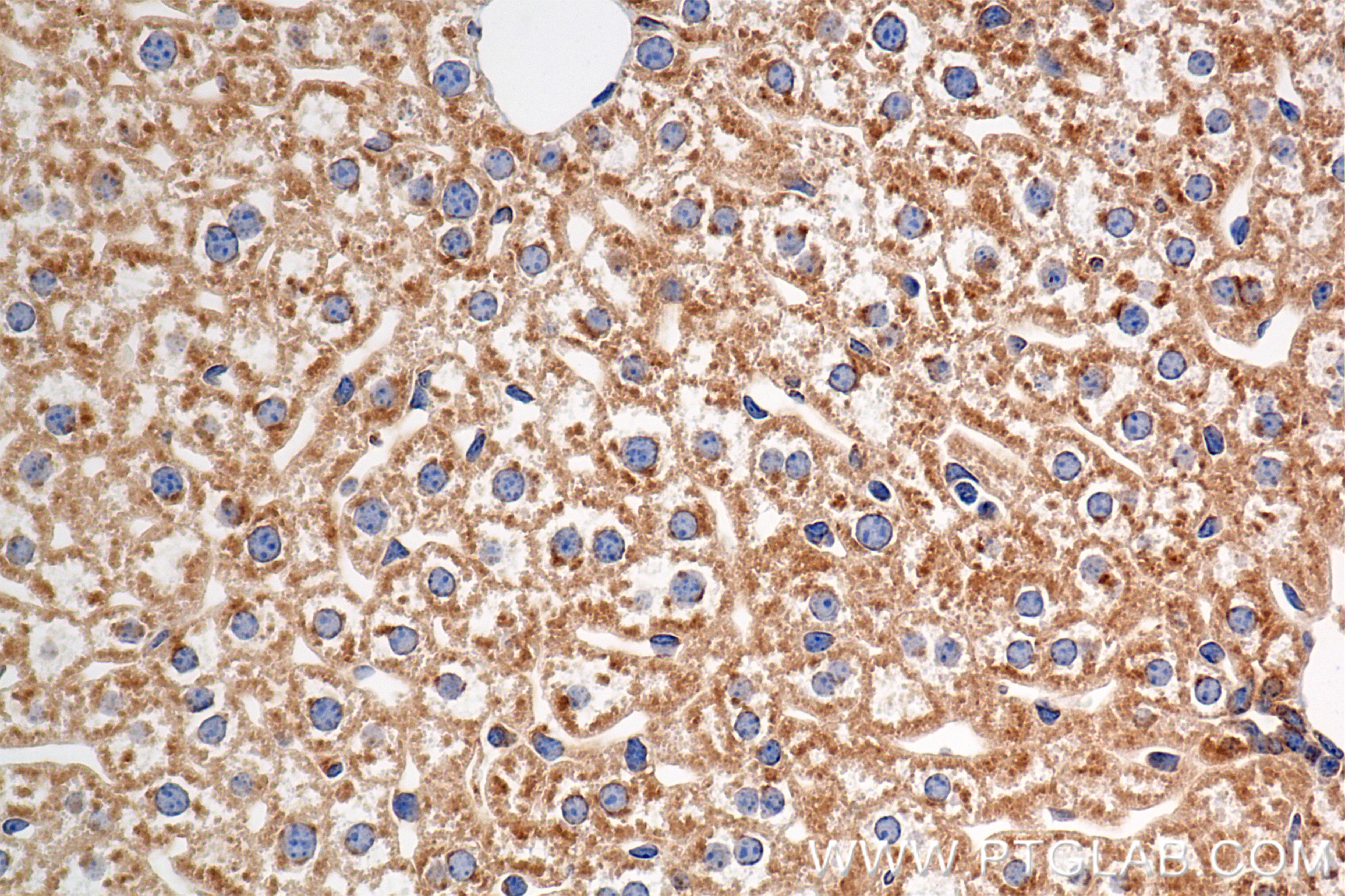 Immunohistochemistry (IHC) staining of mouse liver tissue using ATP13A1 Recombinant monoclonal antibody (86762-3-RR)