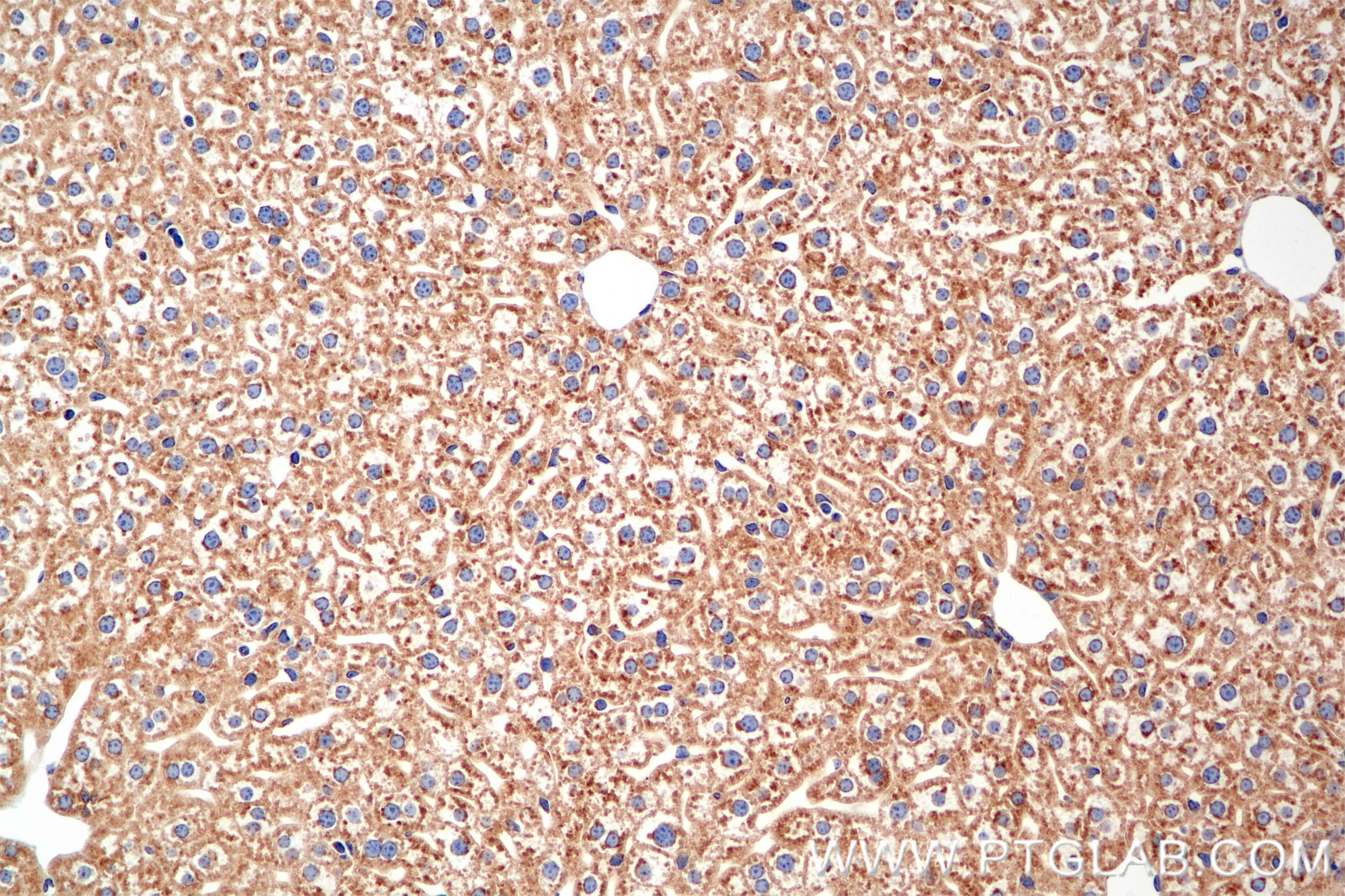 Immunohistochemistry (IHC) staining of mouse liver tissue using ATP13A1 Recombinant monoclonal antibody (86762-3-RR)