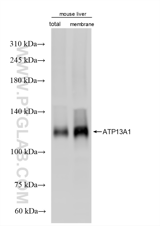 Western Blot (WB) analysis of mouse liver tissue using ATP13A1 Recombinant monoclonal antibody (86762-3-RR)