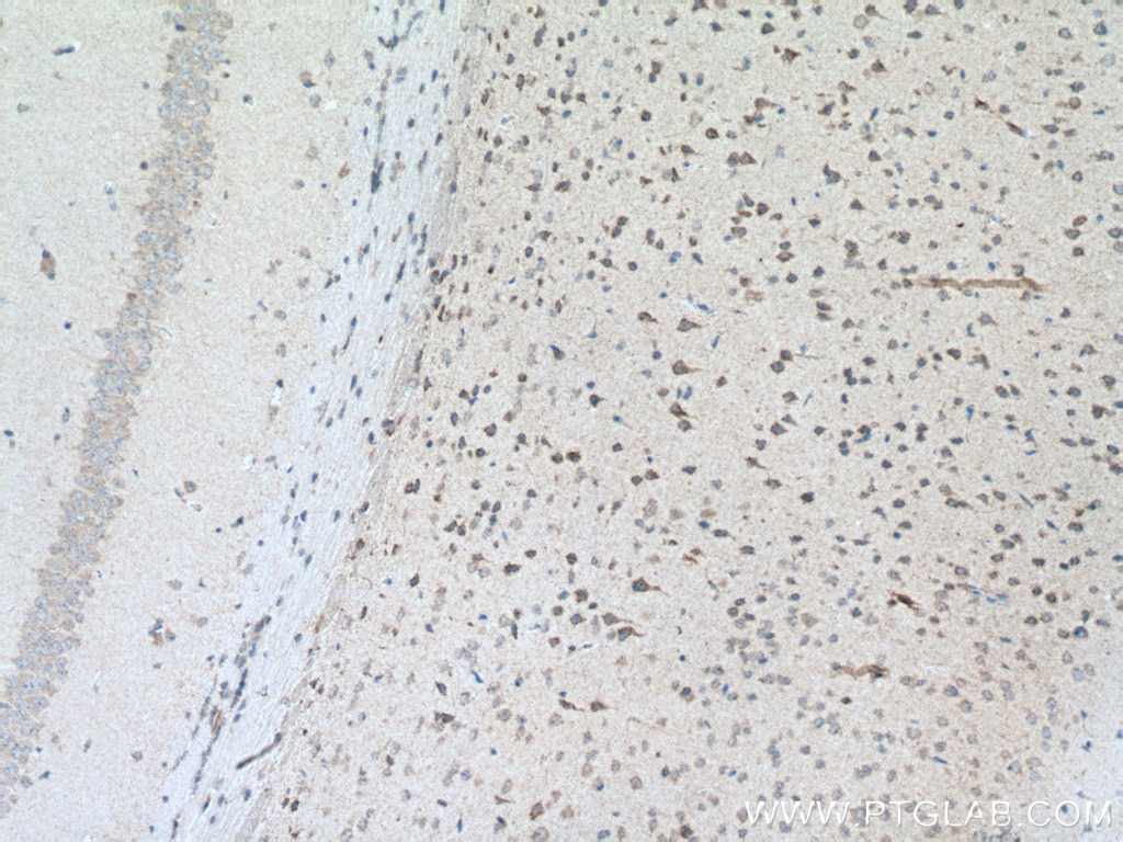 Immunohistochemistry (IHC) staining of mouse brain tissue using PARK9/ATP13A2 Polyclonal antibody (19141-1-AP)