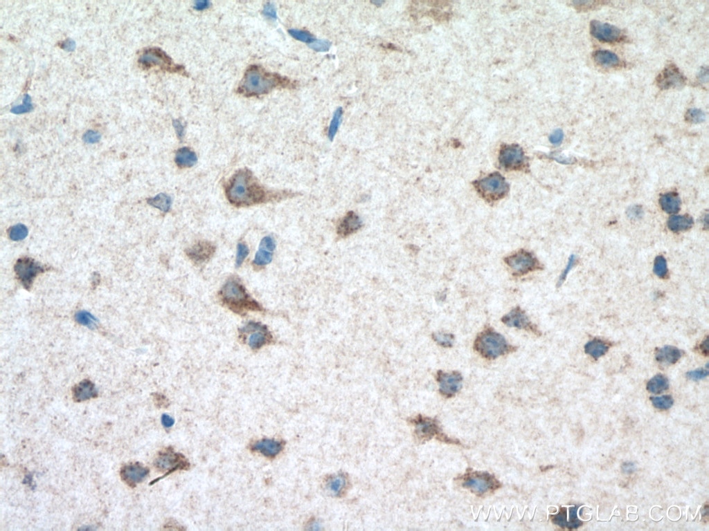 Immunohistochemistry (IHC) staining of mouse brain tissue using PARK9/ATP13A2 Polyclonal antibody (19141-1-AP)