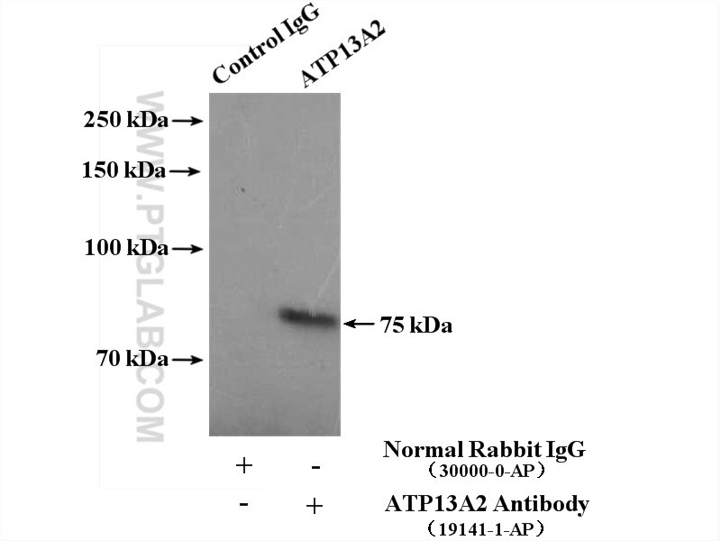 PARK9/ATP13A2
