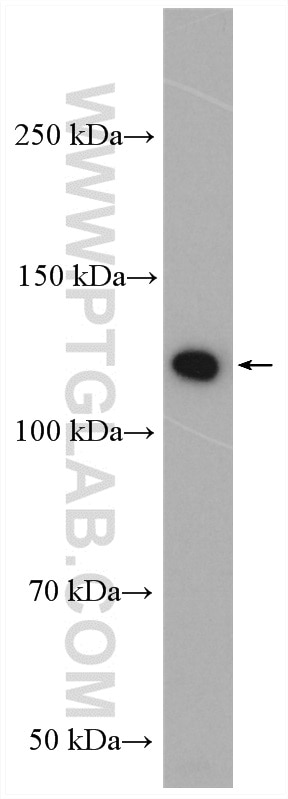 Western Blot (WB) analysis of mouse brain tissue using PARK9/ATP13A2 Polyclonal antibody (19141-1-AP)