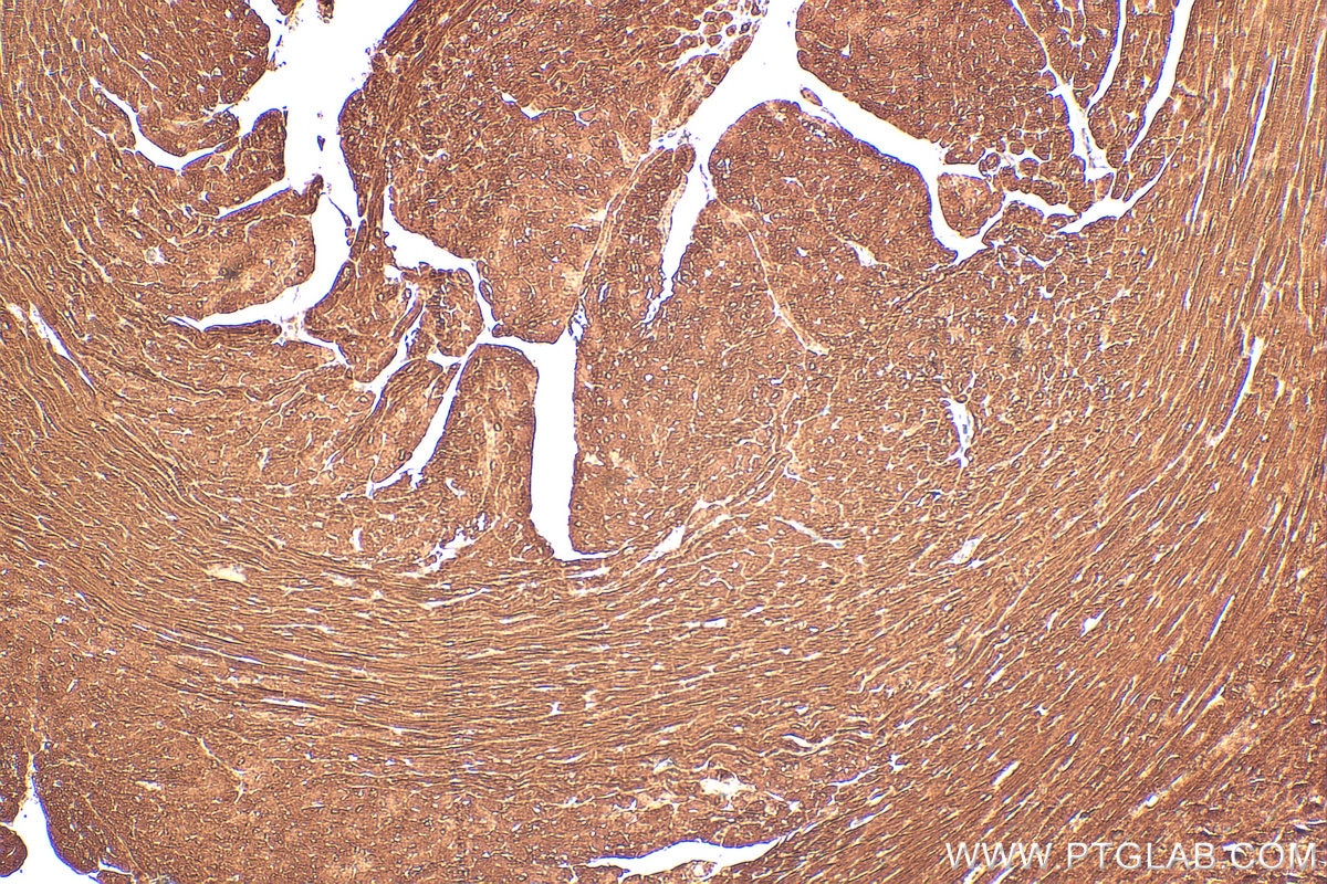 Immunohistochemical analysis of paraffin-embedded mouse heart tissue slide using 55108-1-AP (ATP13A3 antibody) at dilution of 1:200 (under 10x lens). Heat mediated antigen retrieval with Tris-EDTA buffer (pH 9.0). Immunohistochemistry (IHC) staining of mouse heart tissue using ATP13A3 Polyclonal antibody (55108-1-AP)